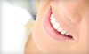 Javadi Smiles Coupons La Mesa, California Deals