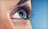 LaserVue Eye Center Coupons Mountain View, California Deals