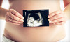 Expectation Ultrasound Studio Coupons Houston, Texas Deals