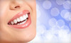 Icing Teeth Whitening Coupons  Deals