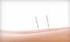 The Chiropractic & Physical Therapy Center of New Jersey Coupons Belleville, New Jersey Deals