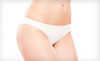 Lipo Laser Coupons Merrillville, Indiana Deals