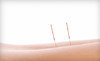 Great Lakes Wellness Group Coupons East Lansing, Michigan Deals
