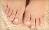 Advanced Aesthetics Medical Spa Coupons East Amherst, New York Deals