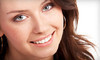 Screamin' White Teeth Coupons Denver, Colorado Deals
