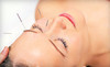 Acupucture of Milford Connecticut Coupons Milford, Connecticut Deals