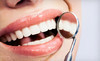 The Studio for Exceptional Dentistry Coupons Colorado Springs, Colorado Deals