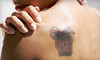 180medspa Coupons Winter Park, Florida Deals
