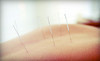 Davidson Acupuncture Coupons Santa Barbara, California Deals