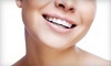 DaVinci Teeth Whitening Systems Coupons Rockford, Illinois Deals