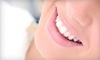 Pro White Teeth Whitening Coupons Columbia, South Carolina Deals