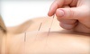 Acupuncture-Integrative Medicine, LLC Coupons Lexington, Kentucky Deals