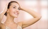 Simplicity Laser Hair Removal Coupons Centennial, Colorado Deals