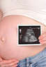 Baby Bundle 3D/4D Ultrasound Coupons Charlotte, NC Deals
